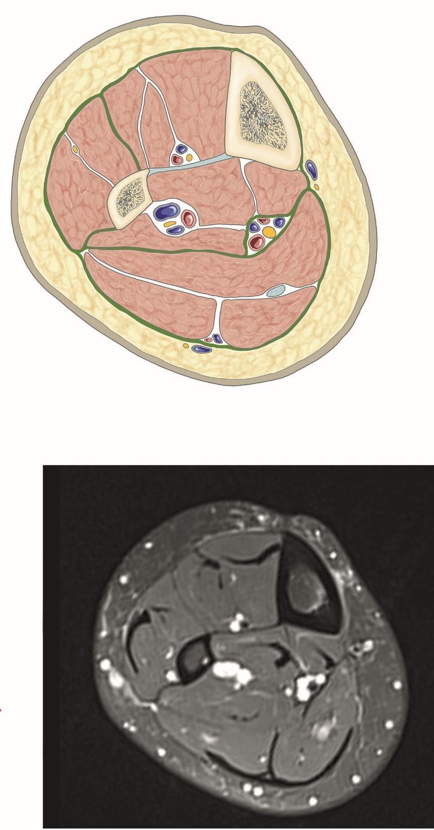 Grim, Naňka, Helekal: Atlas Anatomie člověka I,