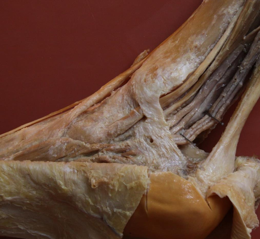 retinaculum mm.