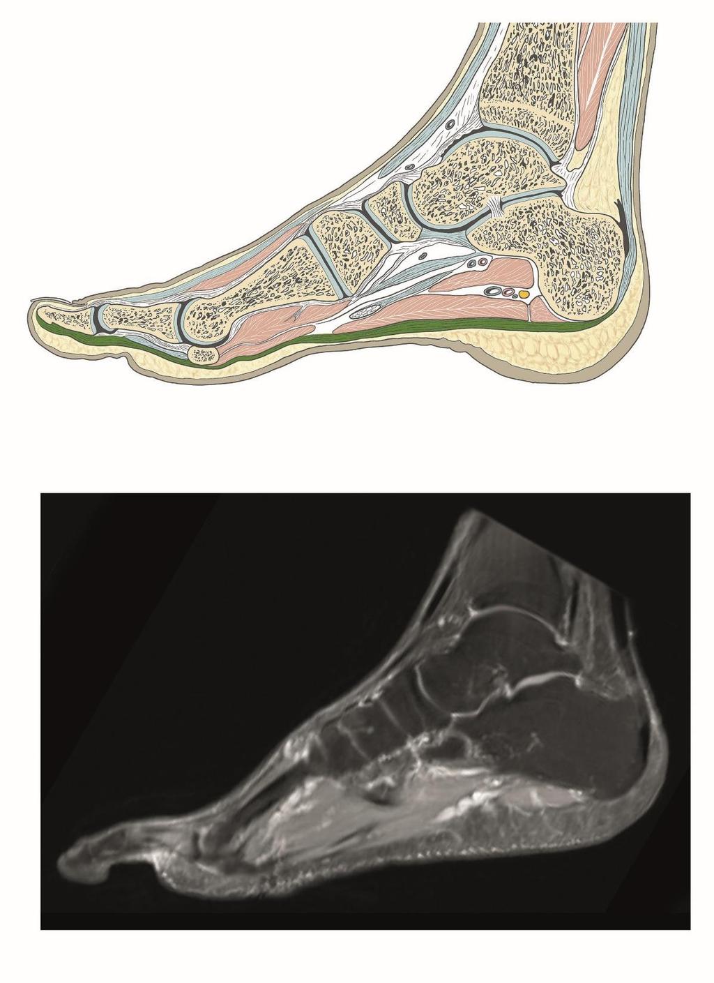 Klenba nožní - brání utlačování měkkých tkání v plantě, umožňuje pružnost při došlapování Grim, Naňka, Helekal: Atlas Anatomie člověka I, Grada 2014 příčná dána sklenutím ossa