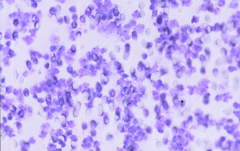 placenta Membrána s