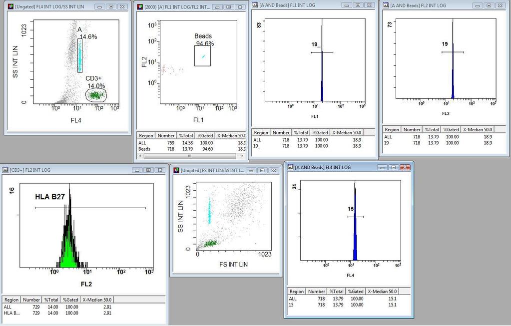 Obrázek 5 Program NAVIOS - označení leukocytů v metodě DURACLONE B27 (screenshot z programu NAVIOS z laboratoře Česká Laboratorní s.r.o.) 2.