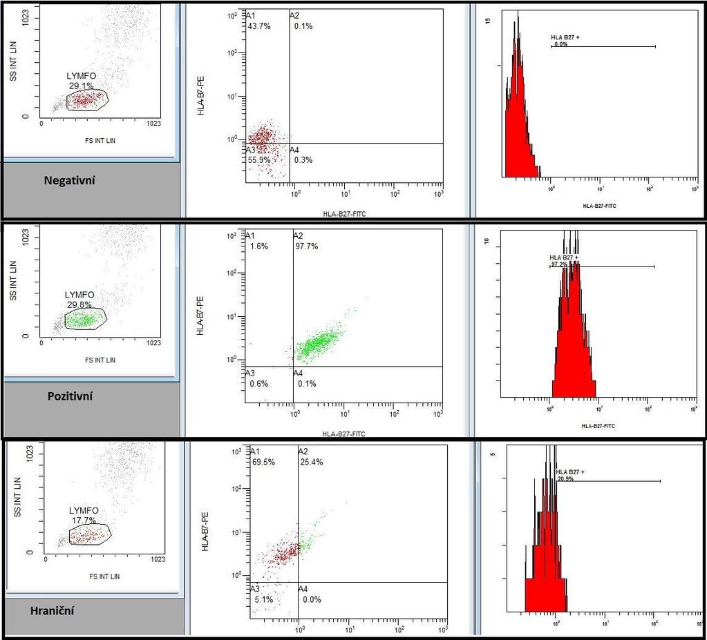 U obou testů (IOtestu i DURACLONE) při interakci monoklonální protilátky s antigenem HLA-B7 a jinými anti HLA-B antigeny může dojít ke křížové reakci, což může způsobit falešnou