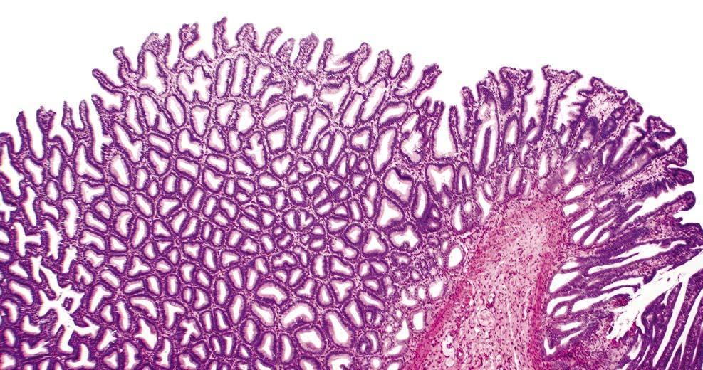 Proč je pro nás důležitá patologie? Autor: RNDr. Ing. Libor Staněk, PCTM Laboratoř Praha, CUBE, synlab czech s.r.o. Nová oblast špičkové laboratorní medicíny, ve které se chce společnost SYNLAB také prosadit, a tím uzavřít pomyslný kruh kompletního laboratorního portfolia, je patologie.