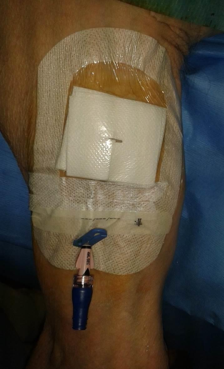 Ošetřený