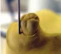 Nejprve se termoplastický materiál změkčí teplem bez chemického působení a pak se vtlačí do speciální kyvety.