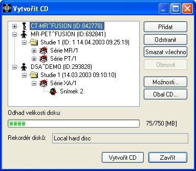 3.27 Archivace studií na CD Tato funkce není dostupná pod operačním systémem MS Windows 98 SE. TomoCon poskytuje uživateli jednoduchou možnost archivace studií na CD nosič pomocí dialogu Vytvořit CD.