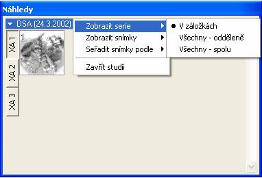 (a) obr. 5 - Zobrazení sérií V záložkách (a), Všechny odděleně (b) (b) obr.