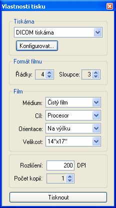 počet řádků a sloupců pracovní plochy, což odpovídá rozložení snímků na filmu (Formát filmu), vlastnosti filmu (Film): typ filmu (Médium), výstupní zásobník pro film
