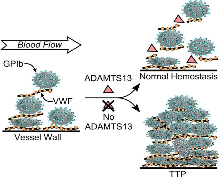 TTP HUS Trombotická thrombocytopenická purpura Hemolyticko uremický syndrom /5 Funkční deficit ADAMTS-13 Metaloproteáza štěpí vysoce