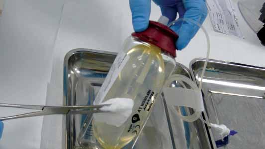 Technologické fórum Podávání kontinuálních infuzí cytostatik pomocí elastomerických infusoru MUDr. Eva Sedláčková, MBA, Onkologická klinika 1. LF UK a VFN Praha PharmDr. Irena Netíková, Ph.D., Fakultní nemocnice Na Bulovce, Oddělení klinické farmacie PharmDr.