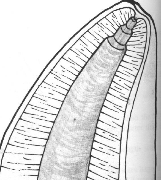 Step back Shortening od root canal