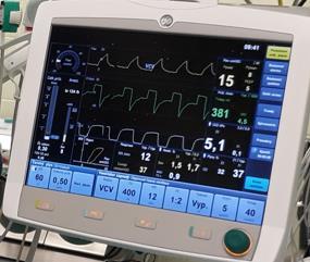 3. EMG aktivita další parametry jiných monitorů: 4.