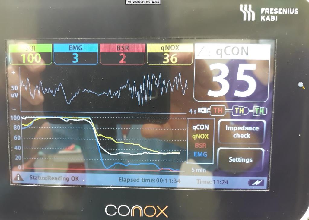 CONOX 14