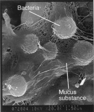 important. Due to the structure of cryoconite granules, it is possible to observe something, what we could call the nutrients micro zones.