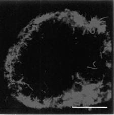 Due to high content of chlorophyll in algae, micro zones are also evident under fluorescence (Takeuchi, Kohshima, and Seko 2001).