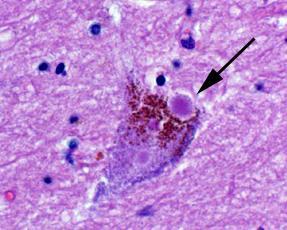 neuronechh PN norma