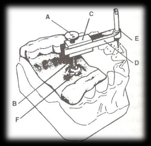 5.4.4 Skupina paralelometrů se zvláštním určením 5.4.4.1 Preparační paralelometry Přezdívané také Parallel-Pin-Instrument.
