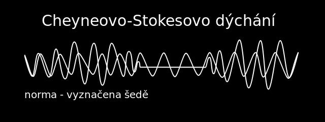 Biotovo dýchání nepravidelné, mělké s apnoickými