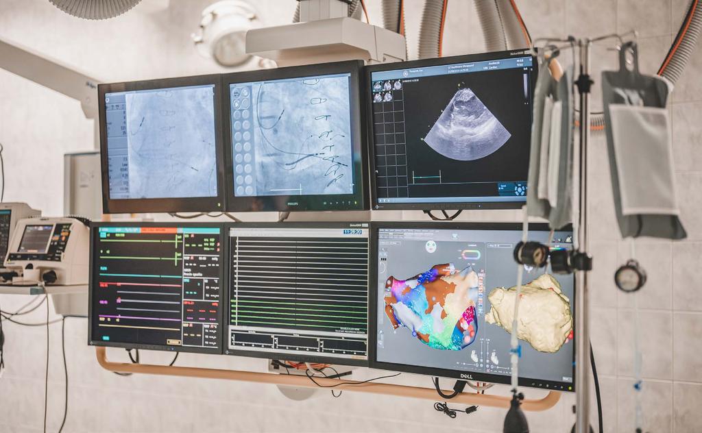 Operační sál s monitory l Foto: Jan Luxík vznikat specializovaná pracoviště koronární jednotky a to se dostalo i k nám. V Československu vznikla první koronární jednotka v roce 1966 v pražském IKEMu.