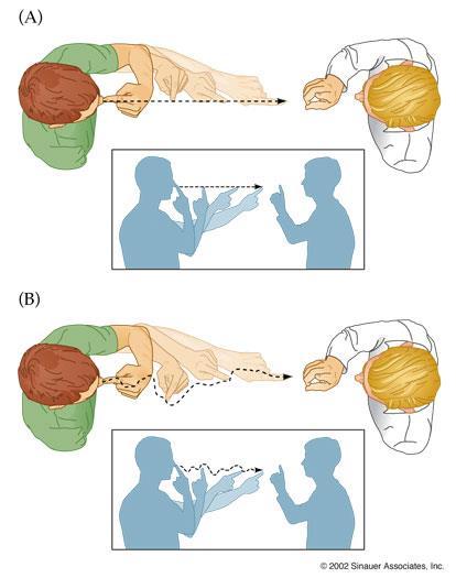 Clinical Findings and Localization of Cerebellar Lesions Ataxia refers to disordered contractions of agonist and antagonist muscles and lack of coordination between movements at different joints