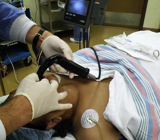 GlideScope zavádění střední čárou uvula kořen jazyka epiglotis