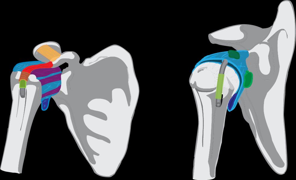 5 Bursa subtendinea musculi subsapularis 9 Střední poloha: