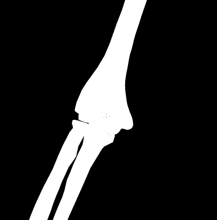 3 Jamka: fovea articularis capitis radii Articulatio cubiti 3 Articulatio radioulnaris proximalis 3.1 Tvar: kolový 3.