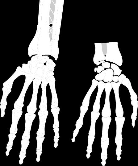 Articulatio radioulnaris distalis 1 Typ: jednoduchý 2 Tvar: kolový 3 Hlavice: circumferentia articularis capitis ulnae 4 Jamka: incisura ulnaris radii 5 Pouzdro: volné,