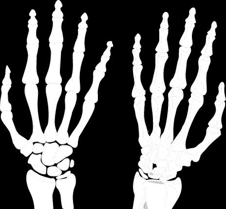 Articulatio radiocarpalis 1 Typ: složený (čtyři kosti, jeden disk) 2 Tvar: elipsový (vejčitý) 3 Hlavice: 3.1 Os scaphoideum 3.2 Os lunatum 3.