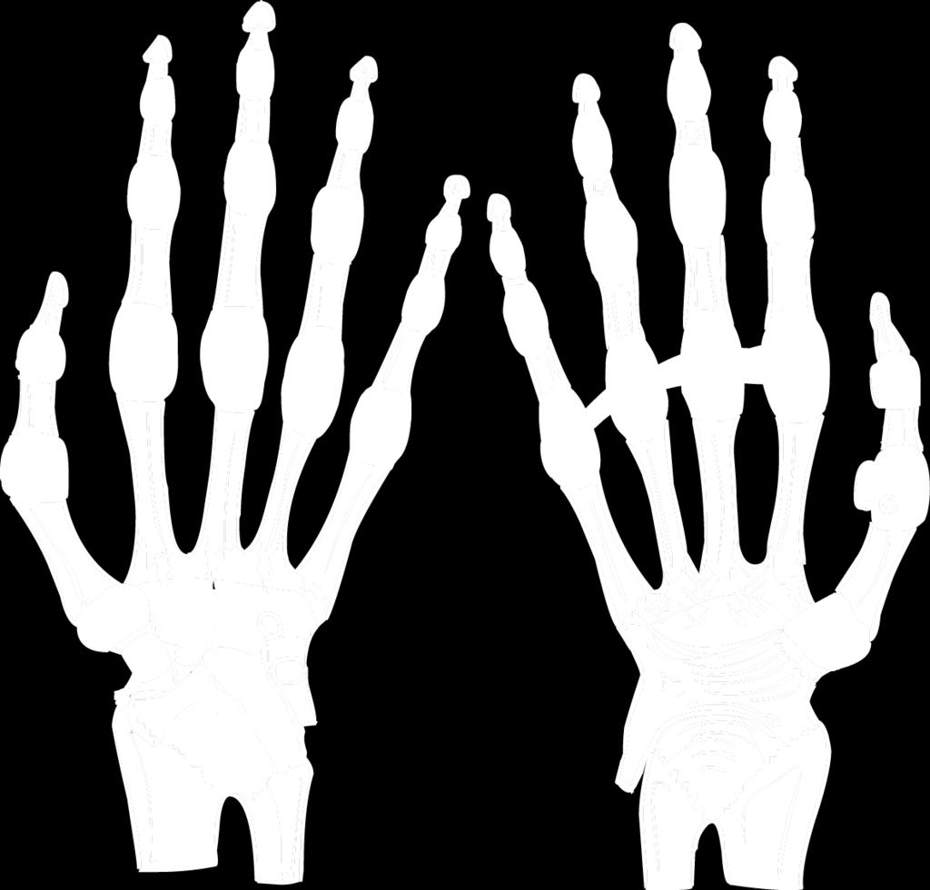 Vazy ruky 1 Vazy: propojují všechny kosti navzájem 1.1 Ligamenta collateralia carpi 1.2 Ligamentum radiocarpale palmare et dorsale 1.