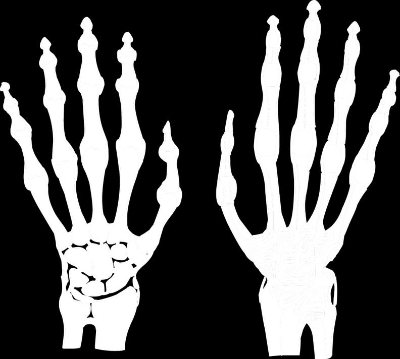 8.2 Ligamentum collaterale mediale et laterale 2 Pohyby: nepatrné 3 Střední poloha: pokračování osy předloktí Kolář, P.