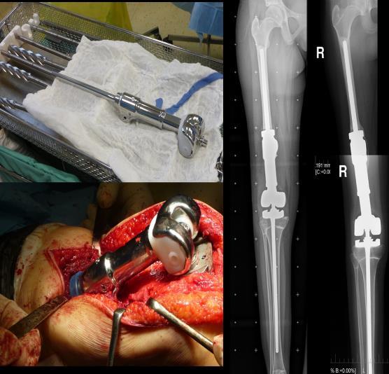 Klinika disponuje sofistikovaným vybavením pro moderní operativu pohybového aparátu včetně navigační jednotky pro implantaci kloubních náhrad, plastiky předního zkříženého vazu a korektivní operace