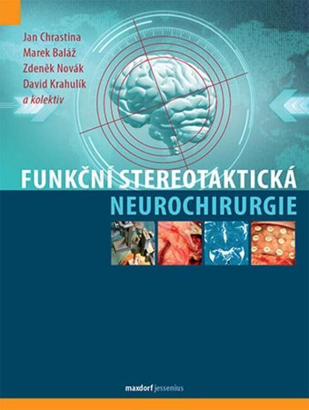 Dalším výrazným programem KPECH je chirurgie prsu, ať ve smyslu profylaktické mastektomie s okamžitou rekonstrukcí (rizikové pacientky) nebo odložených