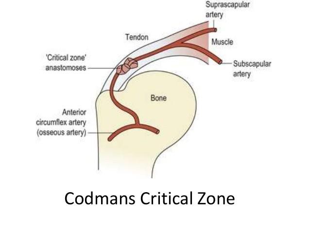 Věk: postupná degenerace šlachy Critical zone - Codman: