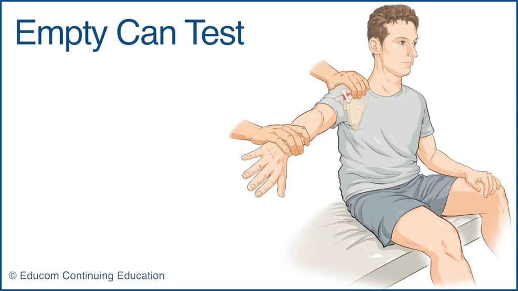 Test - supraspinatus 90st.