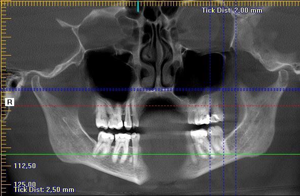 CBCT 101 lenka.