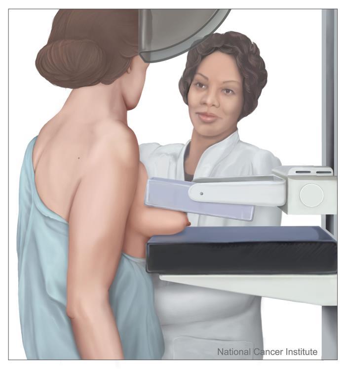 Mammogram