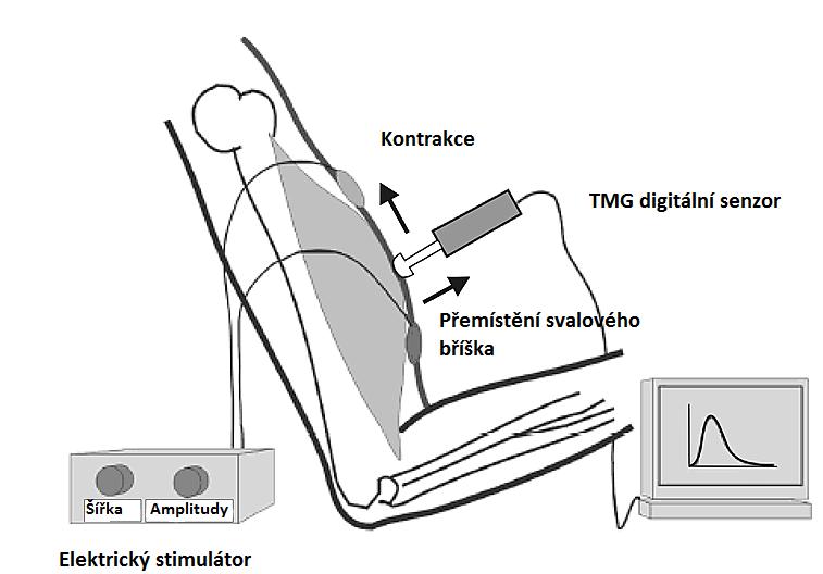 2.6.3. Metoda měření tensiomyografem Tato neinvazivní metoda umožňuje během poměrně krátké doby přesné zjištění svalových údajů.