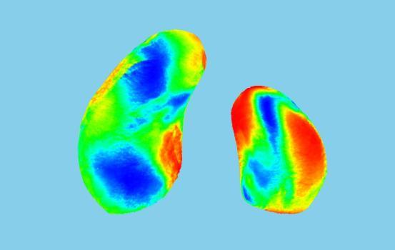 9.38). Největší podíl variability připadá na menší alveolární výběžek, zejména na jeho anteromediální část a středový úsek při laterálním okraji.
