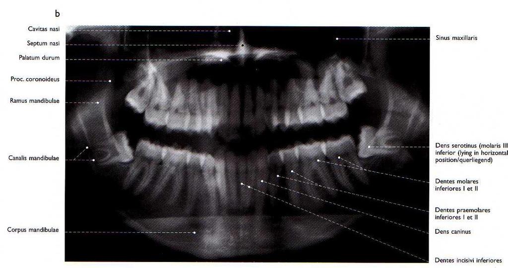 DENTICE