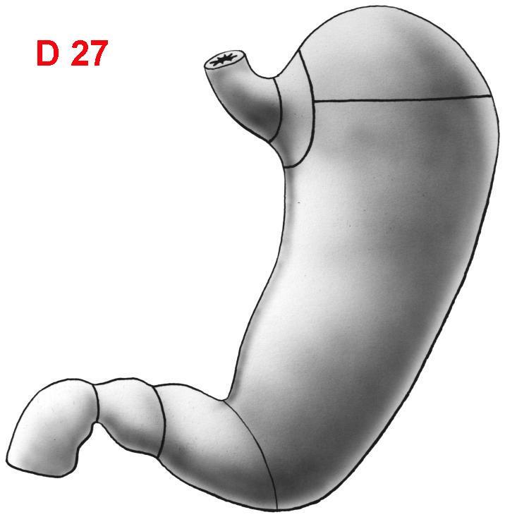 ŽALUDEK (GASTER, VENTRICULUS) Hissův úhel fundus CARDIA