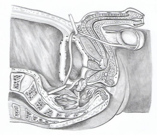 1 anatomickou stavbu a popište funkci jednotlivých orgánů malé pánve muže a ženy: