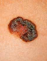 Foto: archiv Dermatovenerologické