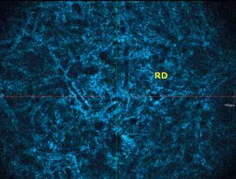 4 Horizontální řez epidermis, SC stratum corneum, SG stratum je na tomto poli prostor granulosum, SS stratum spinosum k dalším výzkumným projektům.