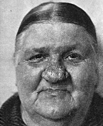 století dostačující zejména z důvodu většího kontaktu a souvislosti dermatologie se všeobecnou patologií.