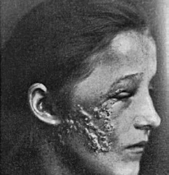 Hlavy (1855 1924), patologického anatoma své éry, nový návrh na dělení chorob kožních. Šamberger kožní nemoci rozdělil nově do 11 tříd: 1. Anomaliae circulationis sanguinis, 2.