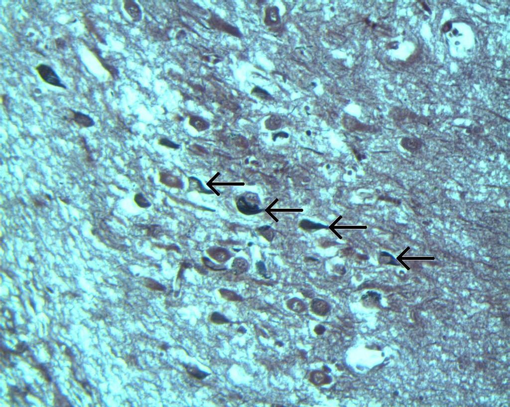 Obr. 16: Hipokampus při Alzheimerově chorobě Impregnace nervových vláken podle Palmgrena (zvětšení: 20x). (Zdroj: Kristýna Havelková) Na tomto preparátu (obr.