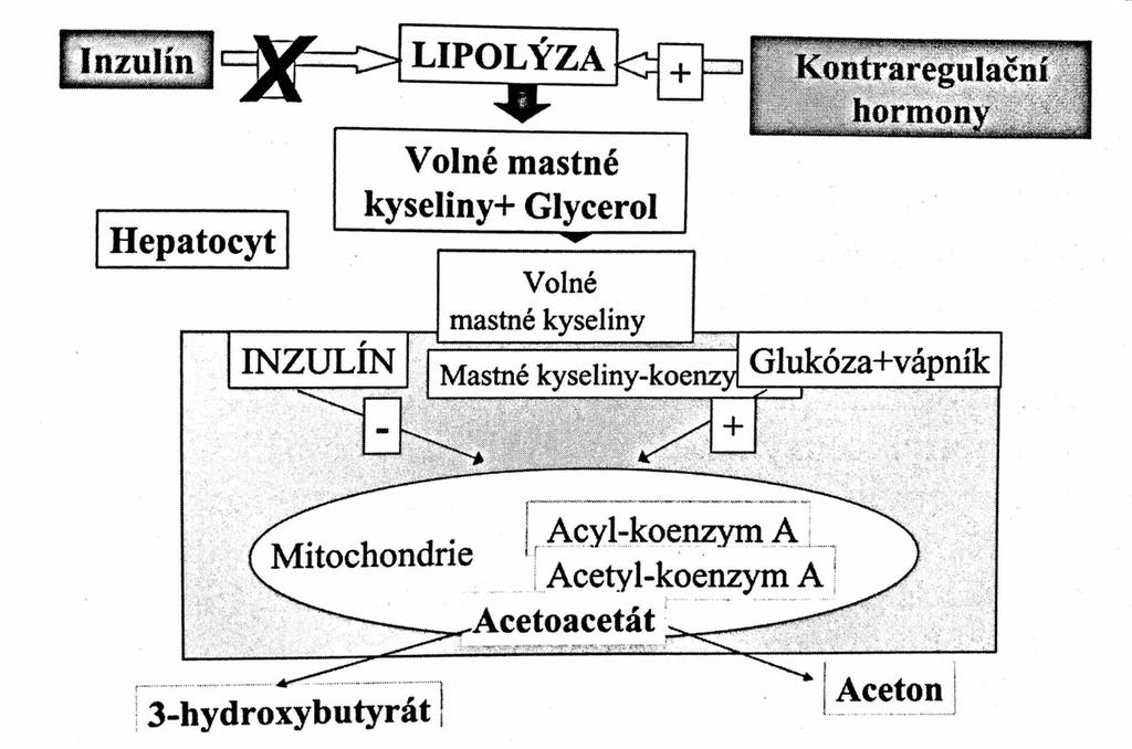 Obrázek 9 Ketogeneze u diabetické katoacidózy (Šmahelová, 2006). Hyperglykémie je doprovázena glykosurií, která podmiňuje osmotickou diurézu. Dochází k dehydrataci a ztrátě velkého množství iontů.