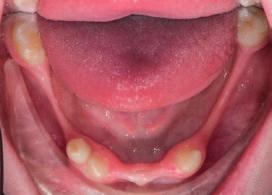 11: CBCT řez v