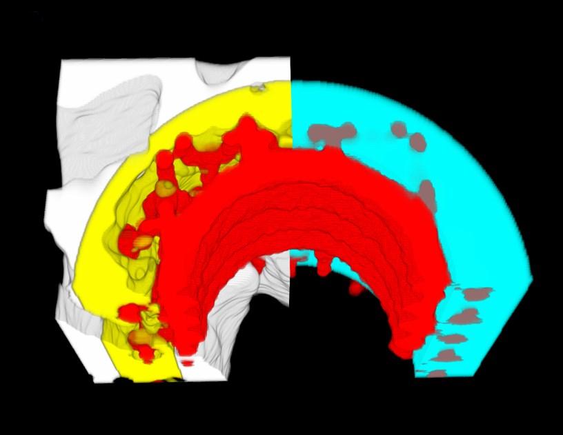 Rekonstrukce projekčních snímků a jejich vizualizace Dataset projekčních snímků (projection images) lze rekonstruovat do datasetu transversálních průřezových snímků (cross-section images).